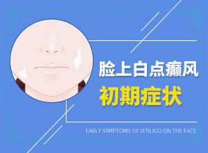 ܰװʲôԭ(岡ʲô)ɫذװʲôԭɵ
