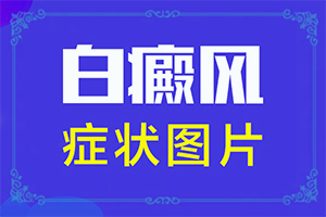 ĴָаװͼƬҪʲô飿ƤЩ